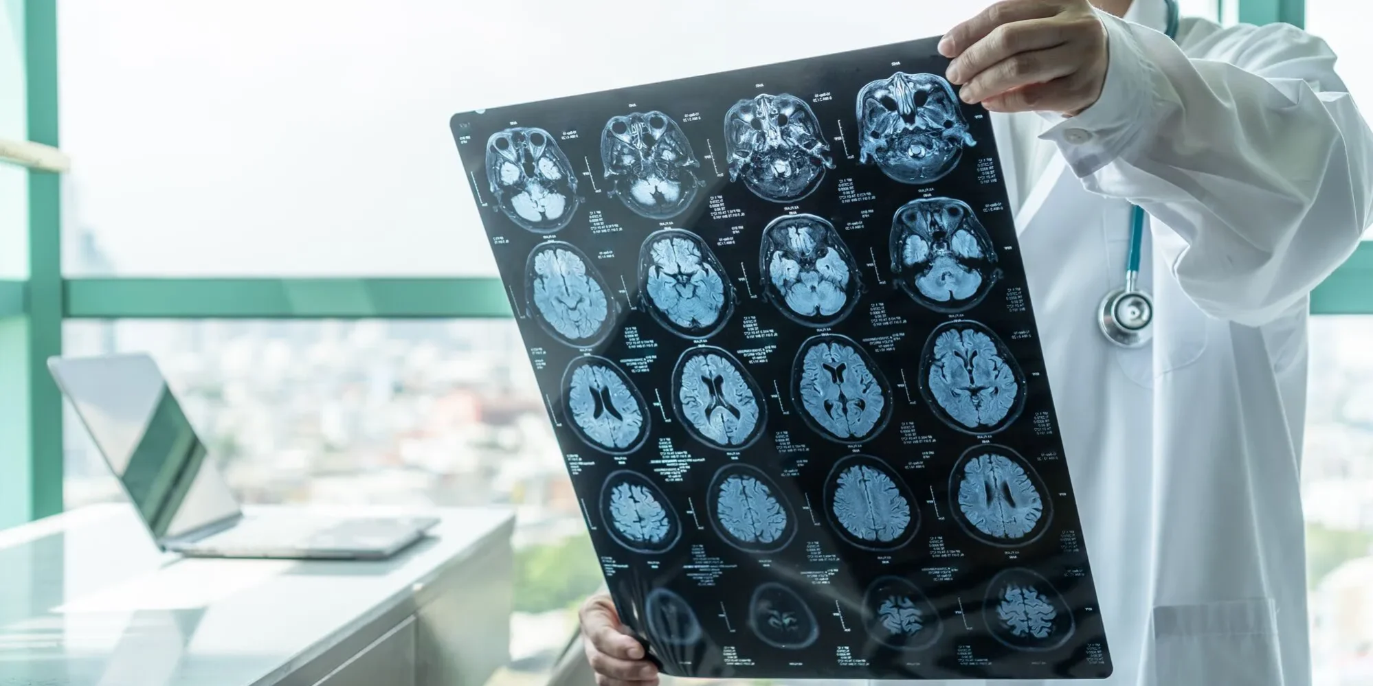 World Head Injury Awareness Day
